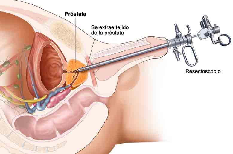 Centre d'Urologie laser Archives | clinique avicenne